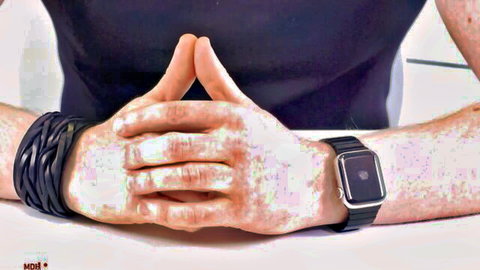 Freckled hands clasped in prayer gesture with black braided bracelets and Apple Watch on wrist