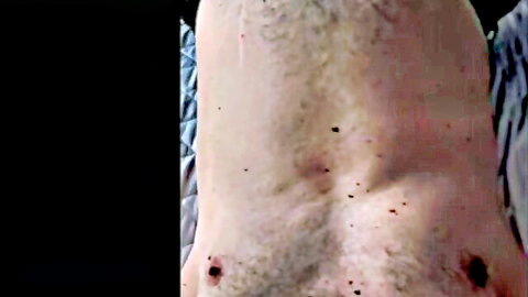 Hairy male belly with red digestion marks in vore fetish scene
