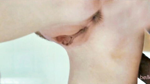 Silvia Saige close-up neck view with surgical scar